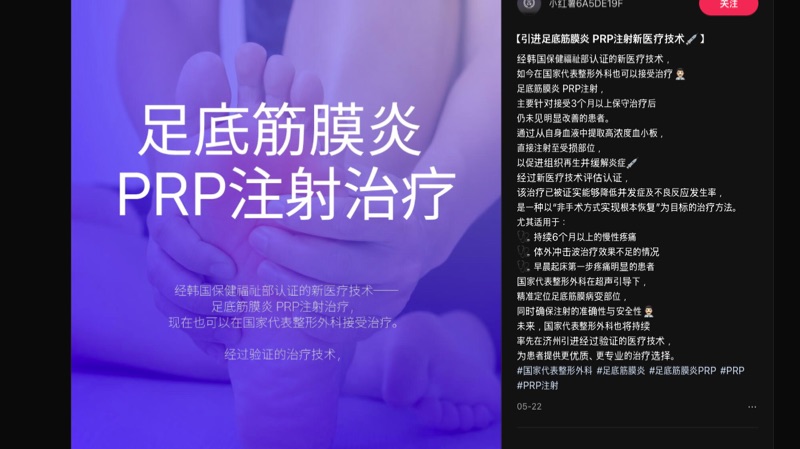 제주점 PRP 치료 샤오홍슈 게시물